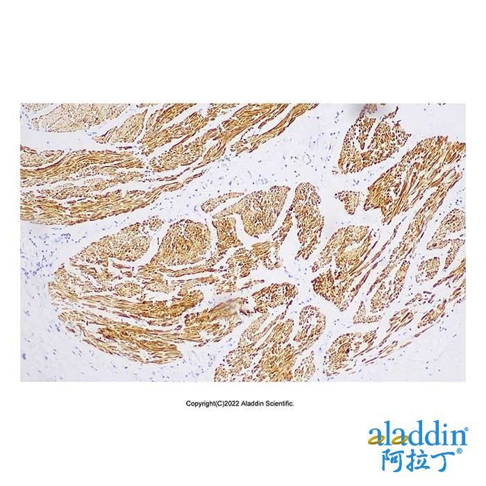 Recombinant Smoothelin Antibody