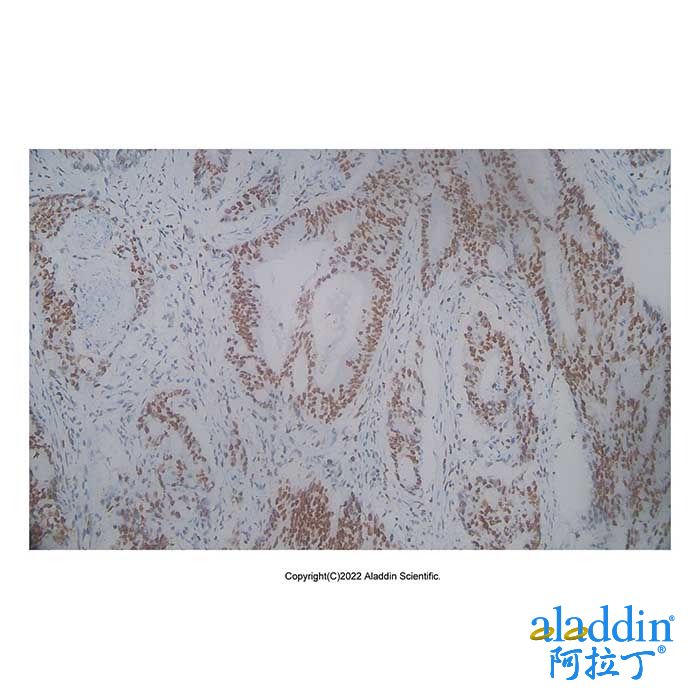 Recombinant MSH2 Antibody