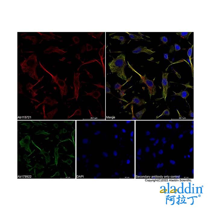 Goat Anti-Rabbit IgG H&L (AF647)