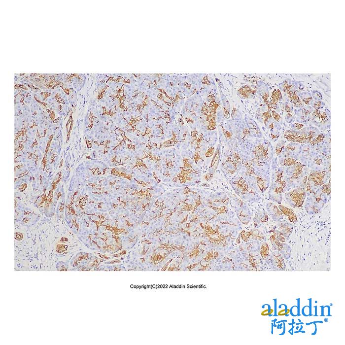 Recombinant CA19-9 Antibody