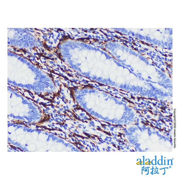 NCAM1 Mouse mAb
