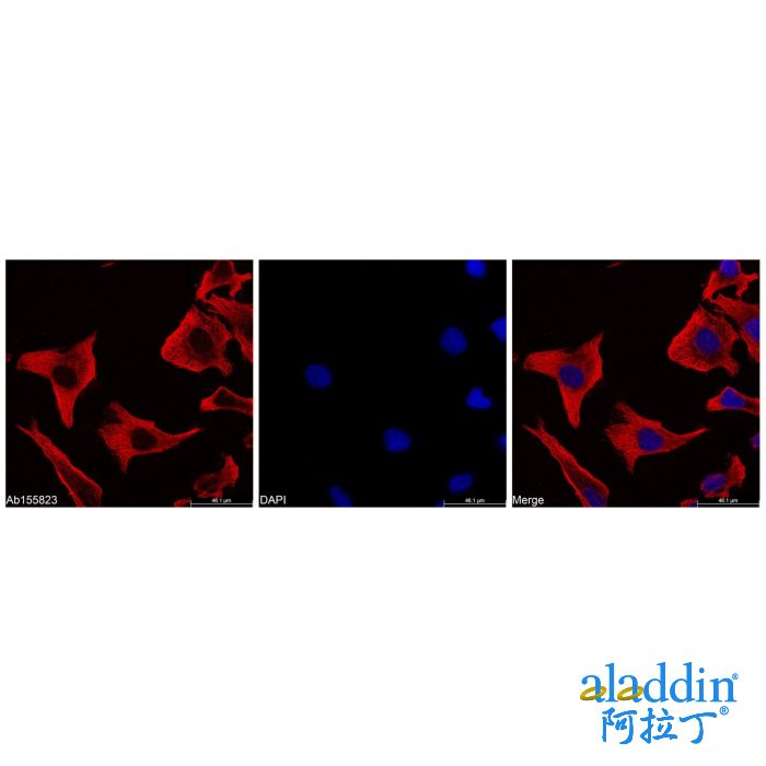 Goat Anti-Mouse IgG H&L (TRITC)