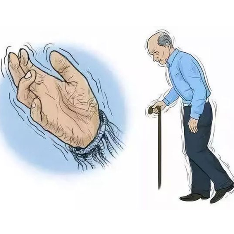 帕金森氏病