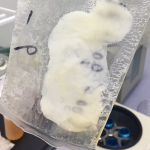 為什么存放于冰箱中的血清會出現(xiàn)沉淀？如何避免該現(xiàn)象？