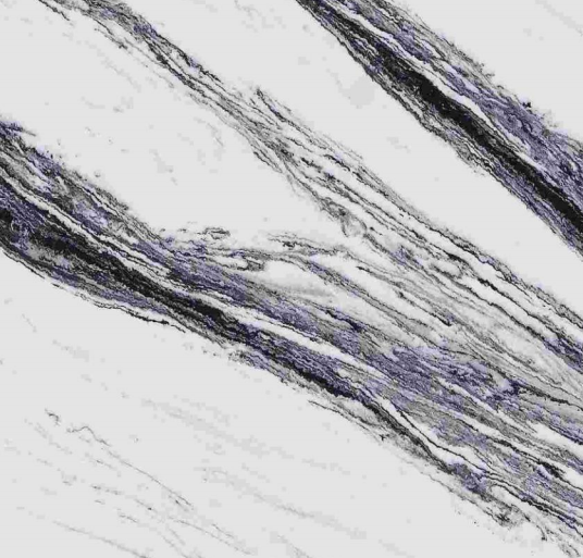 HS-2022615