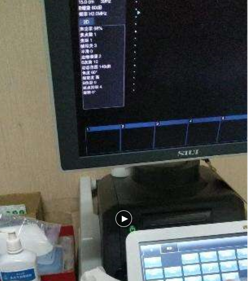 胎儿监护仪维修