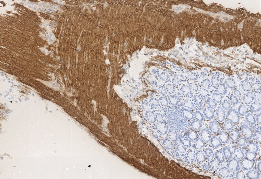 MicroStacker 多聚HRP酶标二抗聚合物 （兔抗大小鼠）