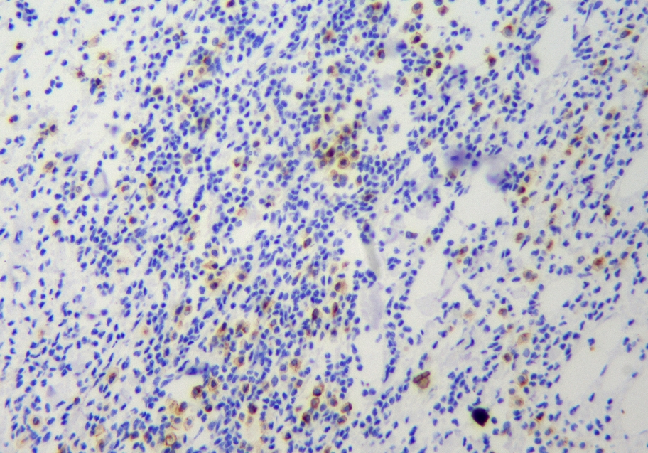 MicroStacker 多聚HRP酶标羊抗鼠聚合物(Pets)