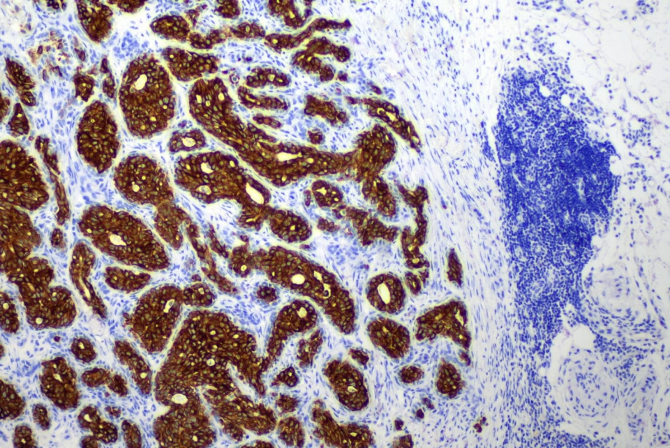 MicroStacker 多聚HRP酶标羊抗免聚合物(Pets)