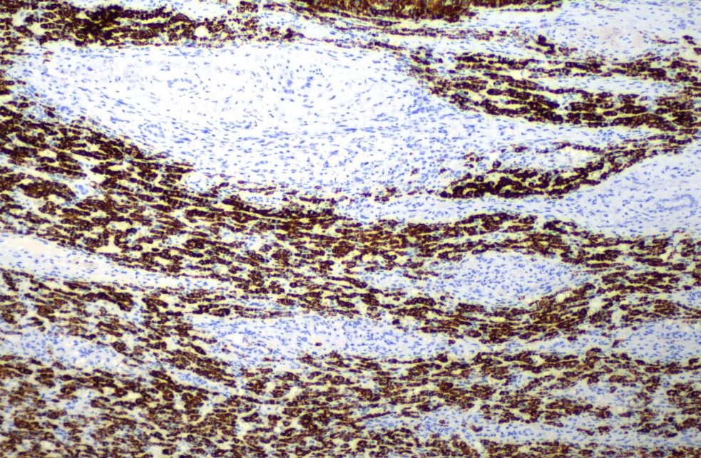 MicroStacker 多聚HRP酶标羊抗鼠/免聚合物(Pets)