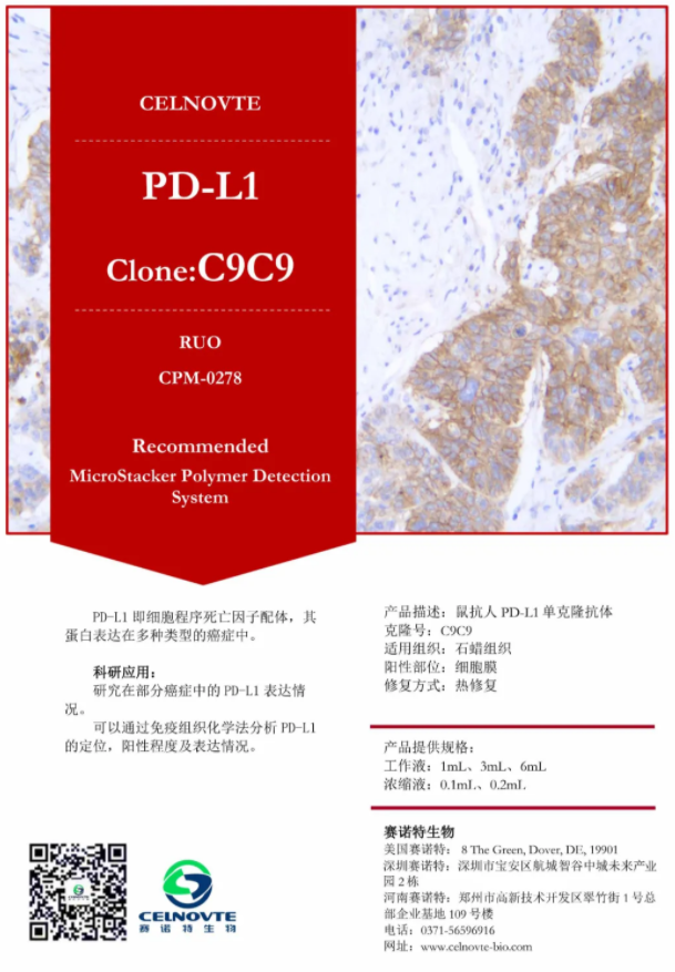 赛诺特新品发布：自主研发IVD免疫组化抗体上新（十三）