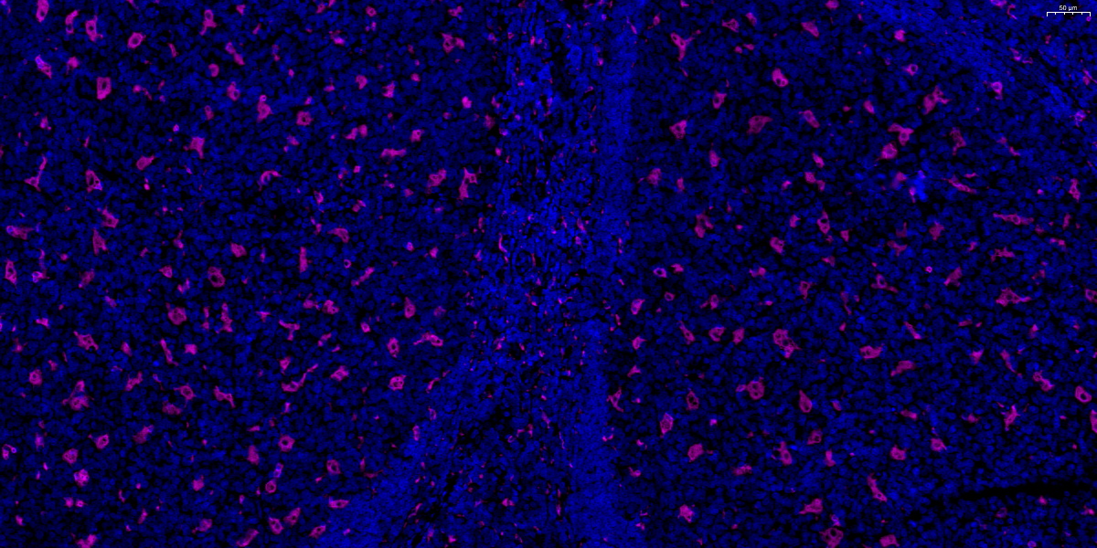 690-CD68-扁桃体-20X