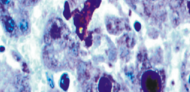 Adenovirus鼠抗人腺病毒单克隆抗体