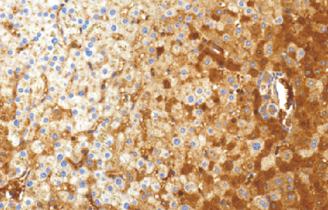 Alpha-1Antitrypsin(AAT)兔抗人a-1-抗胰蛋白酶多克隆抗体