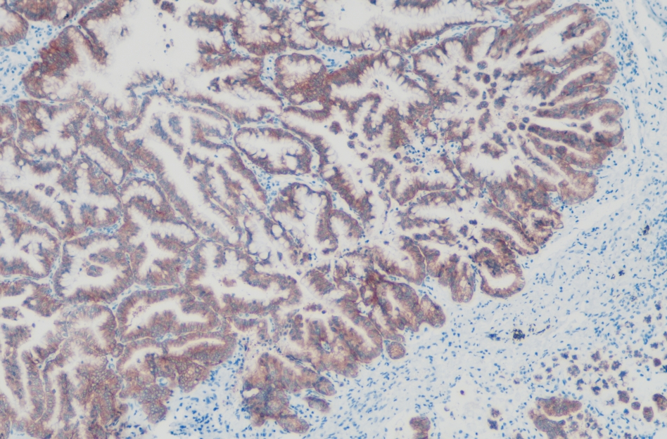 兔抗人间变性淋巴瘤激