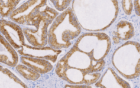 Alpha-Methylacyl-CoA Racemase(AMACRp504s）兔抗人a-甲基酷基辅酶A消旋酶单克隆抗体