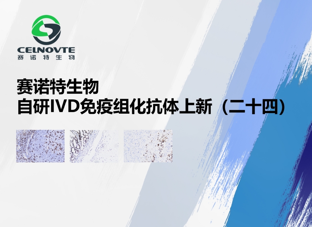 赛诺特新品发布：自主研发IVD免疫组化抗体上新（二十四）