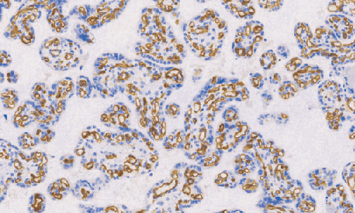 Vascular Endothelial Griowth Factor(VEGF)兔抗人血管内皮生长因子单克隆抗体