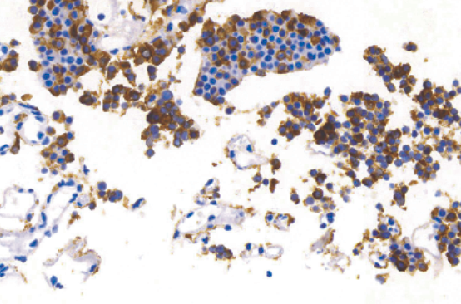 Adrenocoricotropin(ACTH)兔抗人促肾上腺皮质激素多克隆抗体