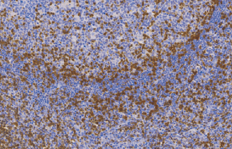 ZAP-70鼠抗人ZAP-70单克隆抗体