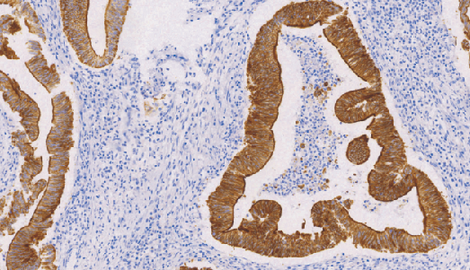 Villin鼠抗人绒毛蛋白单克隆抗体