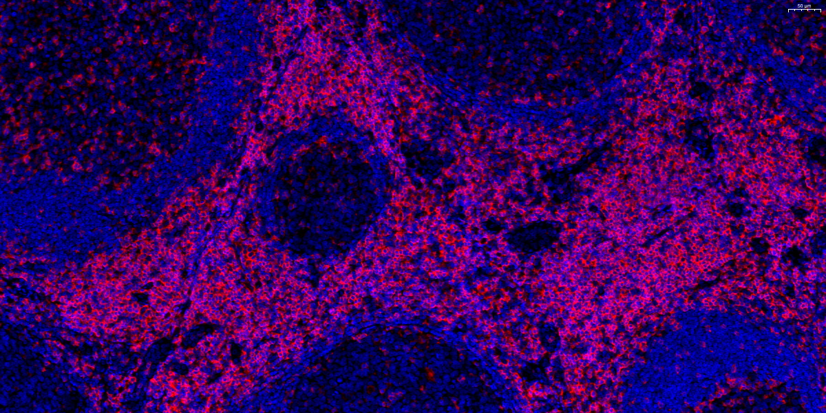 620-CD4-扁桃体-20X