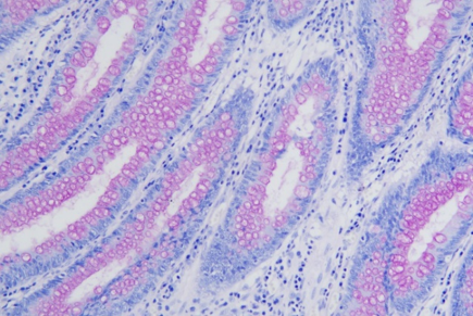 粘蛋白胭脂红染色液