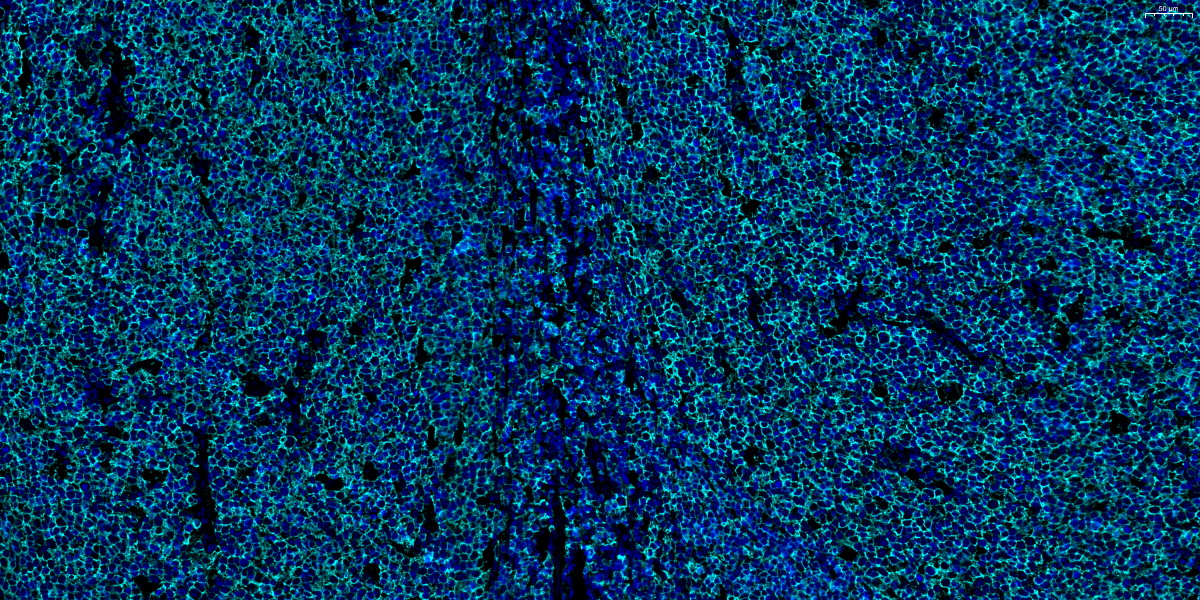 480-CD20-扁桃体-20X