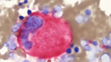 骨髓小巨核细胞产品