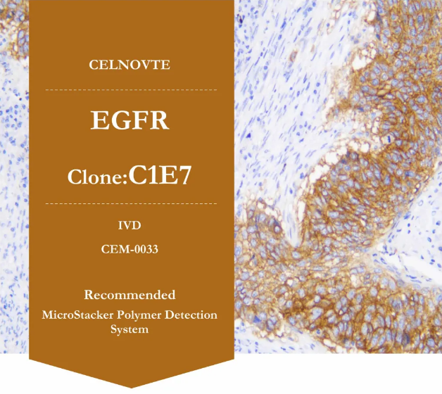 赛诺特新品发布：自主研发IVD免疫组化抗体上新（十二）