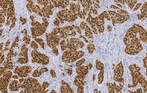 Androgen Receptor(AR)兔抗人雄激素受体单克隆抗体