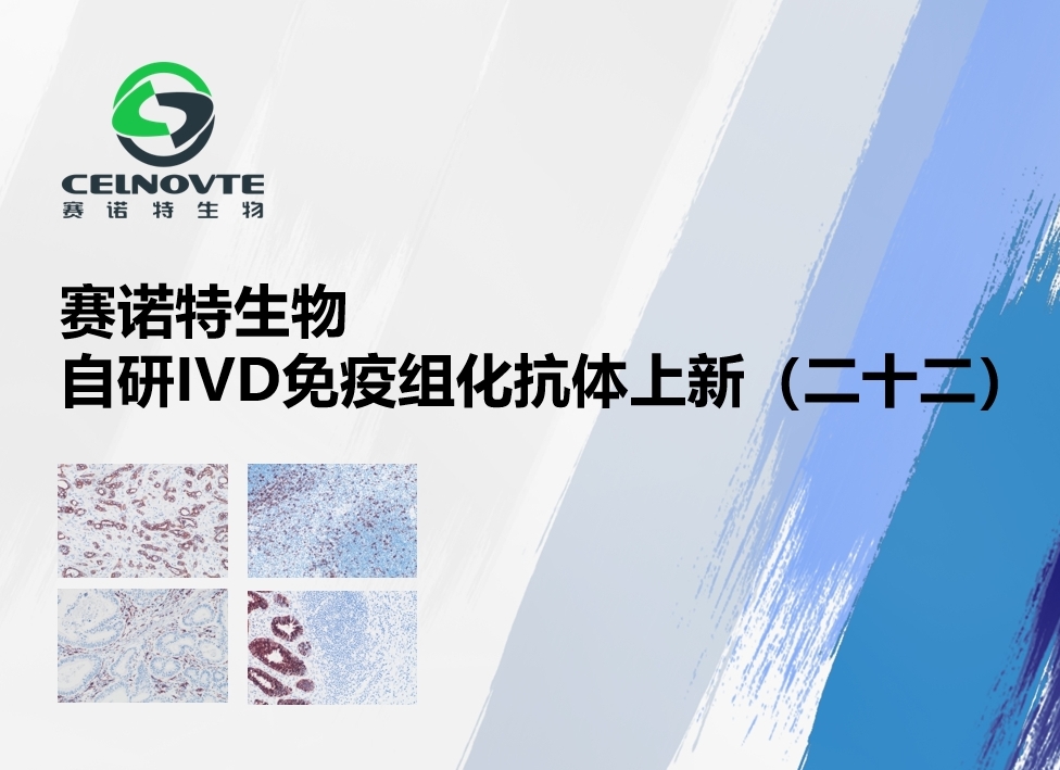 赛诺特新品发布：自主研发IVD免疫组化抗体上新（二十二）