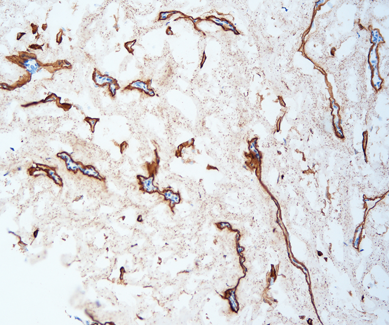 乳腺-胶原蛋白4