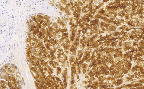 Alpha-Fetoprotein(AFP)鼠抗人甲胎蛋白单克隆抗体