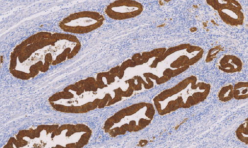 Villin鼠抗人绒毛蛋白单克隆抗体
