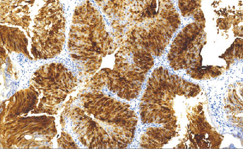 UroplakinIII免抗人UroplakinIII单克隆抗体