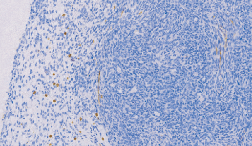 AnnexinA1鼠抗人膜黏连蛋白A1单克隆抗体