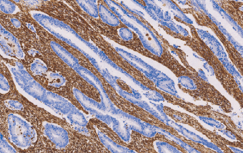 Vimentin鼠抗人波形蛋白单克隆抗体