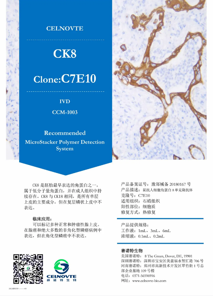赛诺特新品发布：自主研发IVD免疫组化抗体上新（十一）