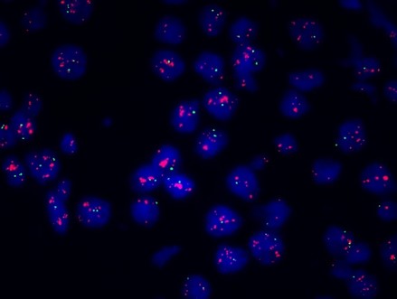 FISH荧光原位杂交平台