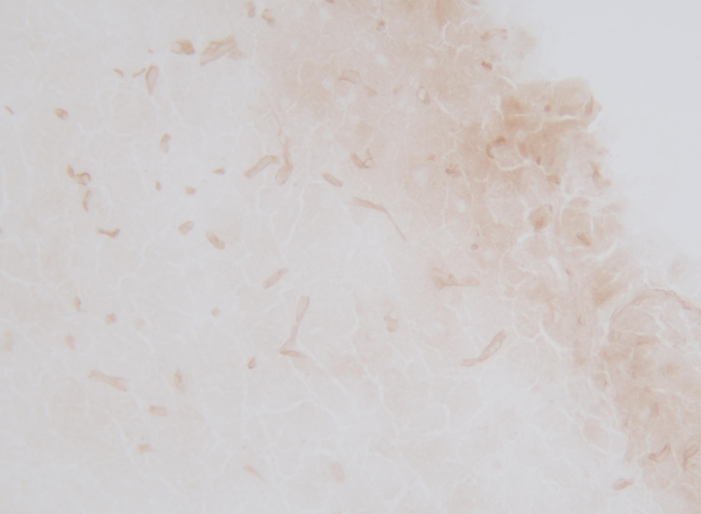 乙酰胆碱酯酶染色液