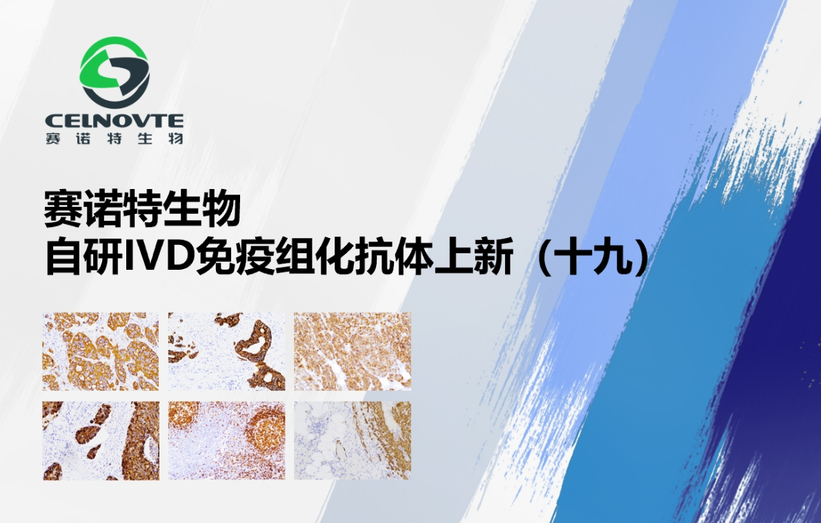 赛诺特新品发布：自主研发IVD免疫组化抗体上新（十九）