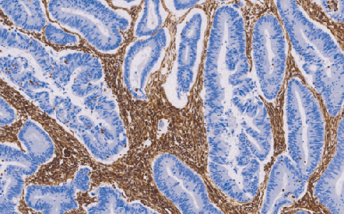 Vimentin鼠抗人波形蛋白单克隆抗体