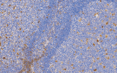 Alpha-1Antichymotrypsin(AACT)兔抗人a-1-抗胰糜蛋白酶多克隆抗体