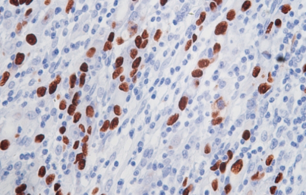 Super-ISH™超级原位杂交平台