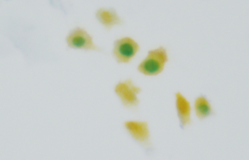 p16/Ki-67细胞变色双染