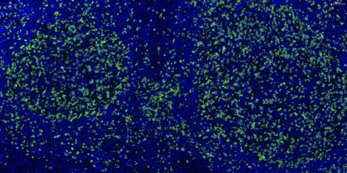 520-CD3-扁桃体-20X