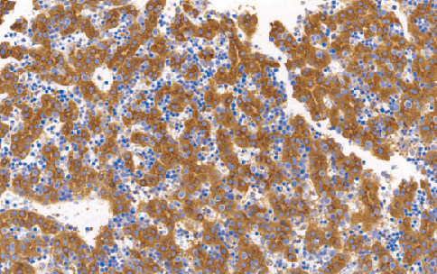 Alpha-Fetoprotein(AFP)兔抗人甲胎蛋白单克隆抗体