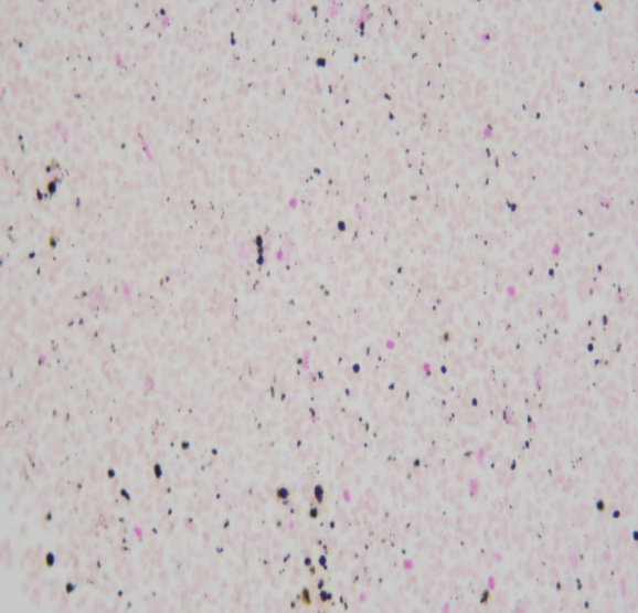 铜盐染色液（红氨酸法）