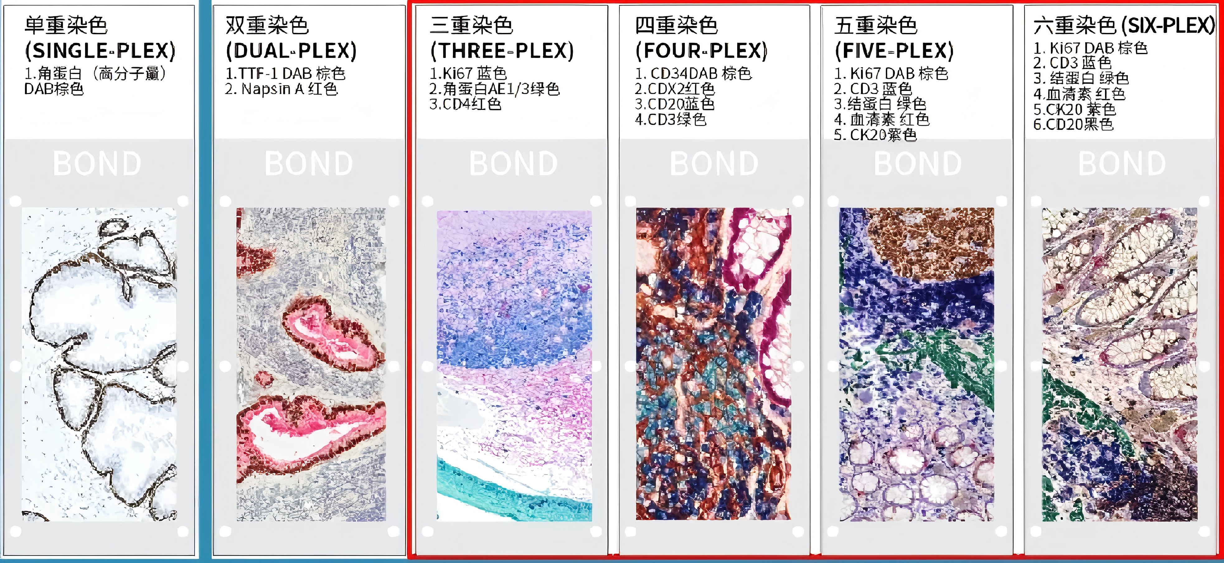 免疫组化未来发展趋势